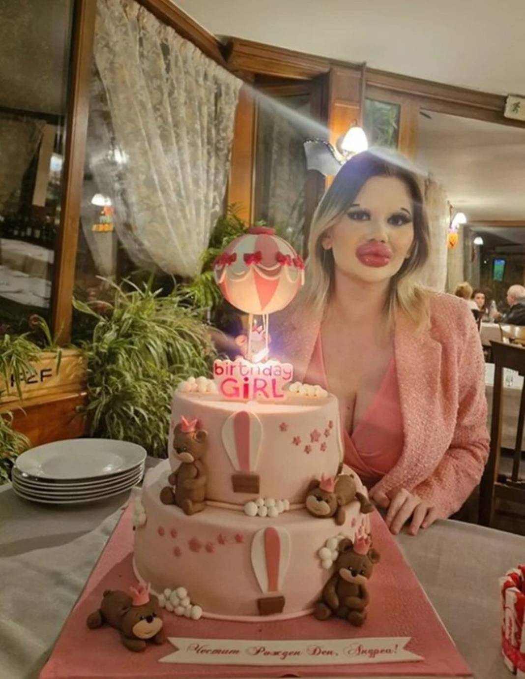 Dudak estetiğine harcadığı para 'dudak' uçuklattı 4